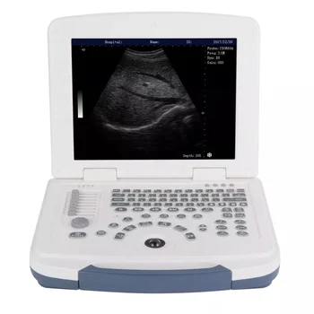 2023 На складе CE Оптовые продажи, полностью цифровое ультразвуковое сканирование, медицинский портативный ультразвуковой аппарат для использования в медицинских больницах